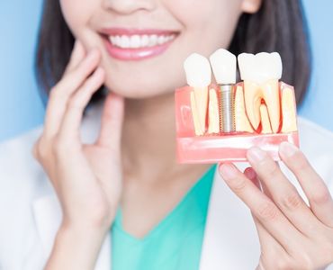 Trabzon Implant Diş